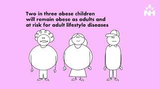 Childhood Obesity  Causes amp Prevention  Narayana Health [upl. by Ailehpo]