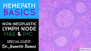 Hemepath Basics NonNeoplastic Lymph Node Histology amp Immunostains with Dr Jeanette Ramos [upl. by Normalie]