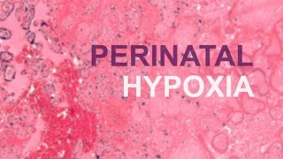 Perinatal Hypoxia [upl. by Evin]