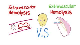 Intravascular Vs Extravascular Hemolytic Anemia Whats The ACTUAL Difference [upl. by Eelyr538]