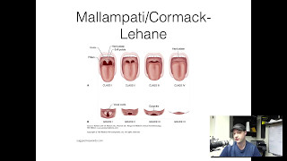 5 minute refresher Difficult Airway Assessment [upl. by Reina]