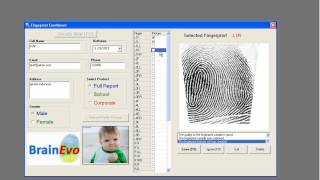 DMIT Fingerprint Analysis  Multiple Intelligences Test [upl. by Alfi132]