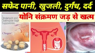 clinadamycin and clotrimazole vaginal suppositories use  सफेद पानी को जड़ से खत्म करने की अदभुत दवा [upl. by Adias]