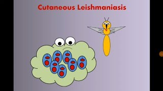 Cutaneous Leishmaniasis الليشمانيا الجلدية [upl. by Etterual839]