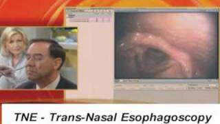 TNE TransNasal Esophagoscope Endoscopy Endoscope GMA [upl. by Ert588]