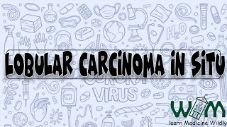 Lobular Carcinoma in Situ [upl. by Nwahsel]