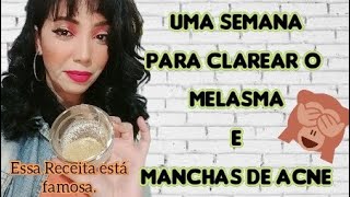 CLAREAR Mancha de Espinha  receita caseira [upl. by Layap]