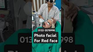 Red face laser treatmentlaser face treatmentlaal face ka treatmentdoctor [upl. by Dibb681]