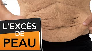 Excès de peau après une perte de poids causes et solutions peau flasque détendue [upl. by Hance]