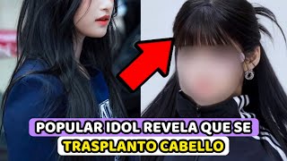 POPULAR IDOL REVELA ABIERTAMENTE QUE SE TRASPLANTO CABELLO [upl. by Eatnhoj262]