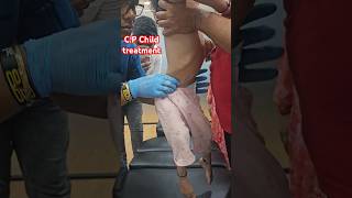 CP Child treatment drrajneeshkant chiropractor worldfamouschiropractor [upl. by Latreese]