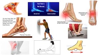 Correct Plantar Fasciitis Quickly Medically Proven The Best Exercises amp Stretches  Dr Mandell [upl. by Soinotna431]