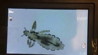 Head lice die in dimethicone  Lice Ninjas [upl. by Ahcropal]