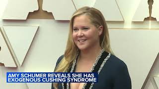 Amy Schumer reveals she has Cushing syndrome [upl. by Sweet]