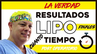 La VERDAD sobre la recuperación de una LIPOSUCCION y los RESULTADOS Lipo lipolaser lipoescultura [upl. by Enifesoj]