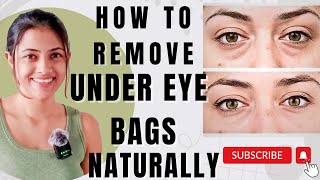 HOW TO REMOVE UNDER EYE BAGS NATURALLY  WHAT CAUSES UNDEREYE BAGS HOW TO GET RID OF UNDEREYE BAGS [upl. by Donadee499]