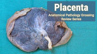 Placenta  Anatomical Pathology Grossing Review Series [upl. by Kristofer]