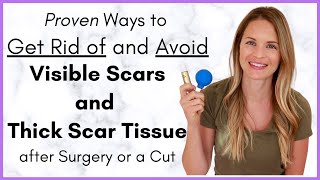 Proven Ways to Heal a Scar Quickly  Avoiding Scar Tissue after Surgery  By a Physical Therapist [upl. by Ycaj]