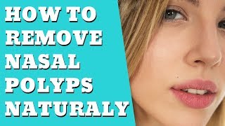 What Are Nasal Polyps  How to remove Nasal Polyps Naturally [upl. by Neliac]