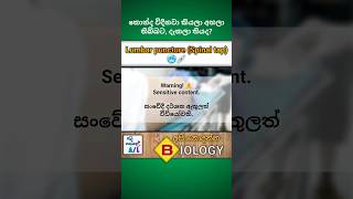 Lumbar puncture Spinal tap💉  Medical biology  අපි නොදන්න Biology  7🫀biology medical shorts [upl. by Zednanref]