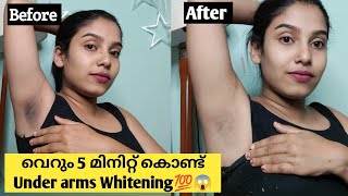 🩸Live Result 🩸Result കണ്ട് ഞെട്ടാൻ Ready ആണോ 😱💯 Under arms whitening home Remdies malayalam [upl. by Eesak269]