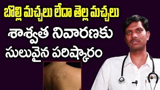 How To Get Rid Of White Spots On Skin  Vitiligo  Ayurvedic Treatment For White Patches [upl. by Joella690]