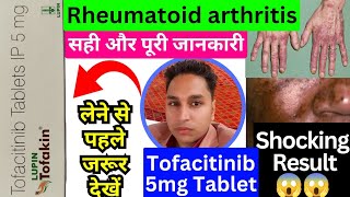 tofacitinib 5 mg tablet hindi  tofacitinib tablets 5mg  tofatas tablet 5 mg  tofakin tablet [upl. by Danny445]