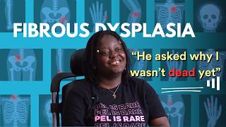 Living With Fibrous Dysplasia [upl. by Inama]