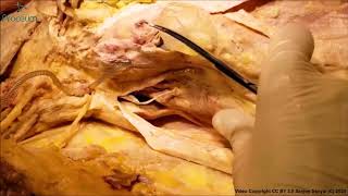 INGUINAL Canal Ligament Sp Cord Ilioinguinal EO Aponeurosis Rectus – Sanjoy Sanyal – Proceum [upl. by Orelia54]