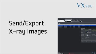 VXvue Quick Guide 05 Send and Export Xray Image [upl. by Atinrev]