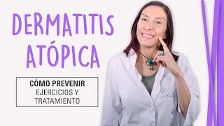 Dermatitis Atópica  Cómo Curar la Piel Atópica [upl. by Yrtua]