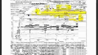 Understanding Clinical Waveforms recorded with the MB Jr  2 of 2avi [upl. by Neisa971]