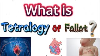 Tetralogy of fallot [upl. by Pastelki204]