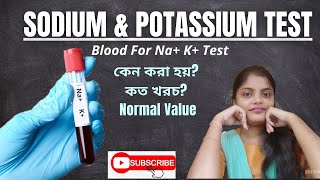 Serum Sodium Test  Serum Pottasium Test  Serum Electrolytes In Bengali [upl. by Soneson]