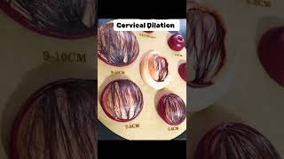 Cervical Dilation trending pregnant cervix cervical dilation [upl. by Dawson]