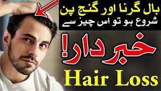 Hair Gerna Start Hon to Khbardar  Baal Ka Gerna  Mehrban Ali  Mehrban TV [upl. by Jerrilee]