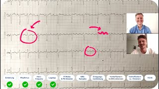 EKG befunden Echtes EKGFallbeispiel mit ärztlicher Auswertung  Kommst du auf die Diagnose [upl. by Richer600]