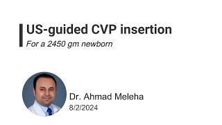 UltrasoundGuided Central Venous Catheter Placement In a 2450g Newborn [upl. by Naasah]