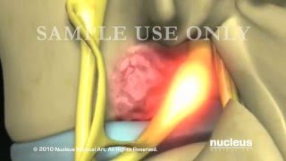 Nucleus Spine Demo Reel 2010 [upl. by Morgun]