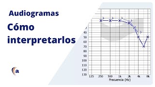 AUDIOGRAMA  Entiende el resultado de una audiometría tonal [upl. by Hazelton]