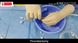 Preparation for Mechanical Thrombectomy Acute Ischemic Stroke [upl. by Alatea]