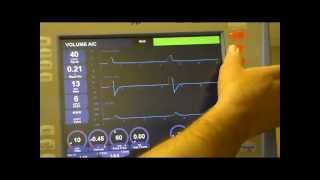 RESPIRATORY CARE AVEA set up [upl. by Thora48]