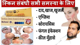 मात्र 5 दिन मे दाद खाज खुजली जड़ खत्म ।। dad khaj khujali ki dava ।। Betzee gm cream uses Hindi [upl. by Lithea]