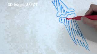 How does bone scintigraphy work [upl. by Ivon441]