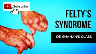 Feltys Syndrome  Dr Shahans Class  Important topic for FMGE and NEETPG [upl. by Esirrehc]