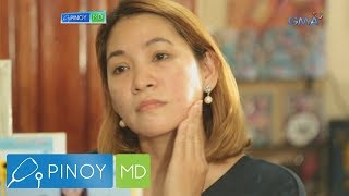 Pinoy MD Solusyon sa acne scars ano nga ba [upl. by Enneyehc]