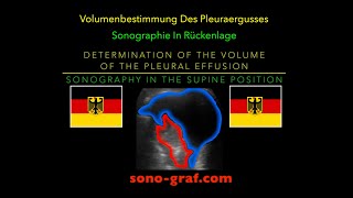 Sonographie  Bestimmung des Volumens des Pleuraergusses in Rückenlage [upl. by Janyte]