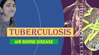 TUBERCULOSIS II MEDICAL MICROBIOLOGY II AIRBORNE DISEASE [upl. by Howes85]