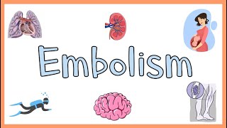 Embolism  Definition Types of Embolism amp Clinical Manifestations [upl. by Jerrold372]