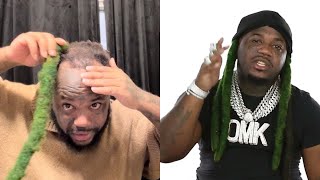 Reggie Baybee Explains Why He Going BALD [upl. by Luci]